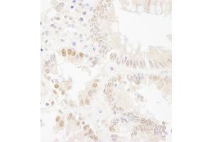 Immunohistochemistry (IHC) image for anti-Budding Uninhibited By Benzimidazoles 1 Homolog (Yeast) (BUB1) (AA 1-50) antibody (ABIN7454620)