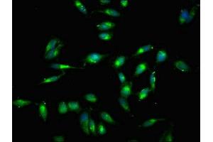 Immunofluorescent analysis of Hela cells using ABIN7172594 at dilution of 1:100 and Alexa Fluor 488-congugated AffiniPure Goat Anti-Rabbit IgG(H+L) (RELB 抗体  (AA 400-579))