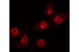 Immunofluorescence (fixed cells) (IF/ICC) image for anti-Acidic (Leucine-Rich) Nuclear phosphoprotein 32 Family, Member C (ANP32C) (Internal Region) antibody (ABIN6258703)