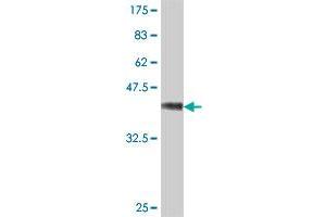 Western Blotting (WB) image for anti-STT3, Subunit of The Oligosaccharyltransferase Complex, Homolog A (STT3A) (AA 603-701) antibody (ABIN561562)