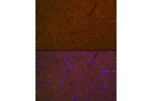 Immunofluorescence analysis of rat brain using 5HT7 Receptor Rabbit mAb (ABIN7265341) at dilution of 1:100 (40x lens). (HTR7 抗体)