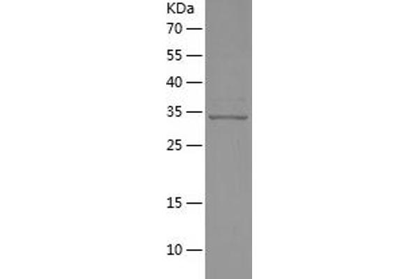 BMP4 Protein (AA 303-408) (His-IF2DI Tag)