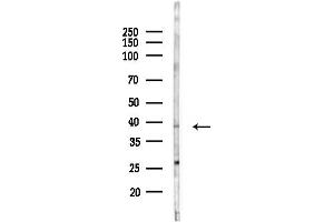 anti-Carcinoembryonic Antigen-Related Cell Adhesion Molecule 8 (CEACAM8) (N-Term) antibody
