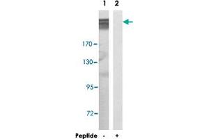 Western blot analysis of extracts from COLO 205 cells, using MEGF8 polyclonal antibody .