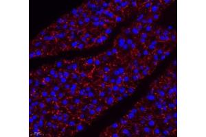 Immunofluorescence (Paraffin-embedded Sections) (IF (p)) image for anti-Aldehyde Dehydrogenase 4 Family, Member A1 (ALDH4A1) antibody (ABIN7073000)