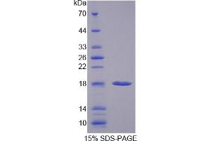 Image no. 1 for Prefoldin Subunit 1 (PFDN1) (AA 1-122) protein (His tag) (ABIN6236907)