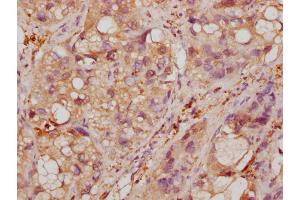Immunohistochemistry (IHC) image for anti-Enolase 1 (ENO1) (AA 2-434) antibody (ABIN7143869)