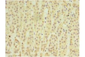 Immunohistochemistry of paraffin-embedded human adrenal gland tissue using ABIN7159049 at dilution of 1:100 (Matrilin 3 抗体  (AA 277-486))