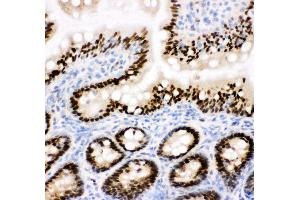 Anti-CTBP2 antibody, IHC(F) IHC(F): Rat Intestine Tissue (CTBP2 抗体  (C-Term))