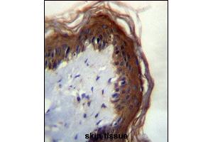 LI Antibdy (C-term) (ABIN656461 and ABIN2845745) immunohistochemistry analysis in formalin fixed and paraffin embedded human skin tissue followed by peroxidase conjugation of the secondary antibody and DAB staining. (LIPM 抗体  (C-Term))