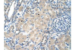SLC13A3 antibody was used for immunohistochemistry at a concentration of 4-8 ug/ml to stain Epithelial cells of renal tubule (arrows) in Human Kidney. (SLC13A3 抗体)