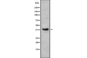 Western blot analysis of RNLS using A549 whole cell lysates (RNLS 抗体  (C-Term))
