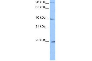 WB Suggested Anti-C4orf33 Antibody Titration: 0.