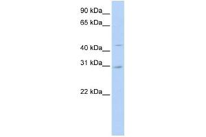 Western Blotting (WB) image for anti-Solute Carrier Family 10 (Sodium/bile Acid Cotransporter Family), Member 4 (SLC10A4) (N-Term) antibody (ABIN2781726)