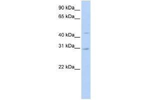 WB Suggested Anti-SLC10A4 Antibody Titration:  0. (SLC10A4 抗体  (N-Term))