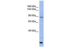 Image no. 1 for anti-Unc-45 Homolog A (UNC45A) (C-Term) antibody (ABIN6744028) (UNC45A 抗体  (C-Term))