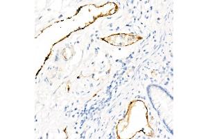 Immunohistochemistry of paraffin-embedded Human colon using von Willebrand factor (VWF) antibody (ABIN7271339) at dilution of 1:800 (40x lens). (VWF 抗体)