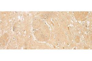 Immunohistochemistry of paraffin-embedded Human brain tissue using MGST3 Polyclonal Antibody at dilution of 1:30(x200) (MGST3 抗体)