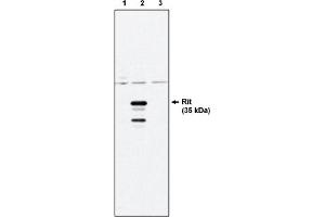 Western Blotting (WB) image for anti-Ras-Like Without CAAX 1 (RIT1) antibody (ABIN264412) (RIT1 抗体)
