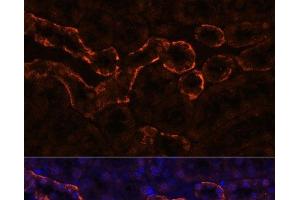 Immunofluorescence analysis of Mouse kidney using AQP3 Polyclonal Antibody at dilution of 1:100. (AQP3 抗体)