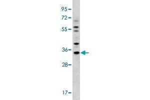 Western blot analysis of MDA-MB-231 cell lysate (35 ug/lane) with GJB5 polyclonal antibody . (GJB5 抗体  (Internal Region))