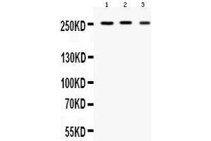 Western Blotting (WB) image for anti-Sodium Channel, Voltage-Gated, Type I, alpha Subunit (SCN1A) (AA 1981-2009), (C-Term) antibody (ABIN3044542)