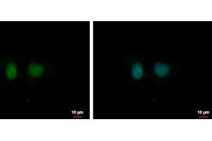 ICC/IF Image DDI1 antibody [N1C3] detects DDI1 protein at nucleus by immunofluorescent analysis. (DDI1 抗体  (Center))