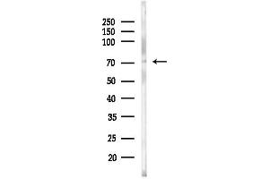 anti-Kallikrein B, Plasma (Fletcher Factor) 1 (KLKB1) (Internal Region) antibody