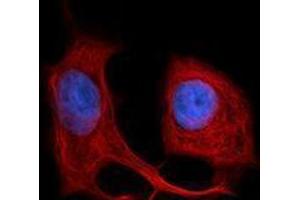 Immunofluorescence (IF) image for anti-Keratin 18 (KRT18) antibody (Alexa Fluor 594) (ABIN2656840) (Cytokeratin 18 抗体  (Alexa Fluor 594))