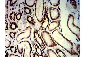 Immunohistochemistry (IHC) image for anti-Paired Box 8 (PAX8) (AA 60-261) antibody (ABIN7193697)