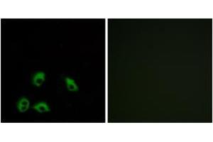 Immunofluorescence analysis of MCF7 cells, using GPR103 Antibody. (QRFPR 抗体  (AA 271-320))
