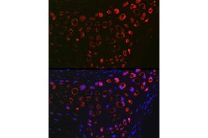 Immunofluorescence (IF) image for anti-Matrix Gla Protein (MGP) (AA 20-103) antibody (ABIN6143825)