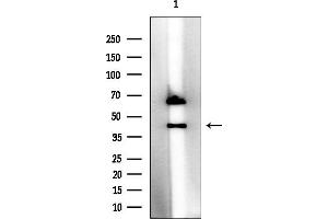 anti-Melanoma Antigen Family B, 6 (MAGEB6) (Internal Region) antibody