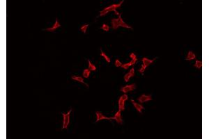 ABIN6266870 staining Hela by IF/ICC. (MAST2 抗体  (Internal Region))