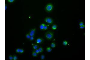 Image no. 3 for anti-Acetyl-CoA Acetyltransferase 2 (ACAT2) antibody (ABIN1496397) (ACAT2 抗体)