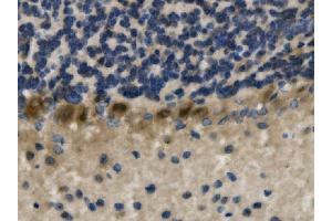 IHC analysis of LHX1 using anti-LHX1 antibody (ABIN7599263). (LHX1 抗体  (AA 1-317))
