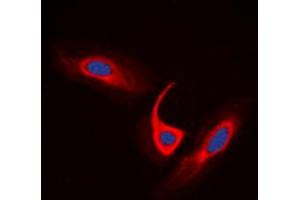 Immunofluorescent analysis of ACOT4 staining in A549 cells. (ACOT4 抗体  (C-Term))