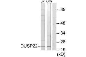 Western Blotting (WB) image for anti-Dual Specificity Phosphatase 22 (DUSP22) (Internal Region) antibody (ABIN1850000) (DUSP22 抗体  (Internal Region))