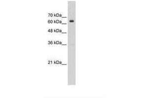 Image no. 2 for anti-BTB (POZ) Domain Containing 14A (BTBD14A) (AA 30-79) antibody (ABIN203337) (BTBD14A 抗体  (AA 30-79))