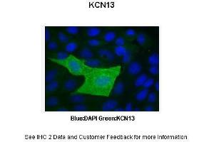 Immunohistochemistry (IHC) image for anti-Potassium Channel Subfamily K Member 13 (KCNK13) (C-Term) antibody (ABIN2776250)