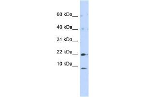 Western Blotting (WB) image for anti-NADH Dehydrogenase (Ubiquinone) 1, Subcomplex Unknown, 2, 14.5kDa (NDUFC2) (N-Term) antibody (ABIN2782645)