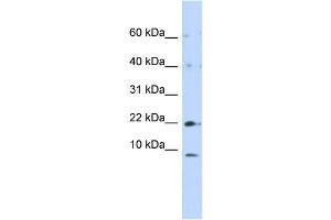 WB Suggested Anti-NDUFC2 Antibody Titration:  0. (NDUFC2 抗体  (N-Term))