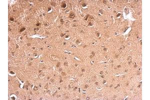 IHC-P Image GAD67 antibody detects GAD67 protein at on mouse fore brain by immunohistochemical analysis. (GAD 抗体  (N-Term))