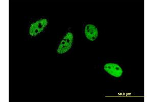 Immunofluorescence of monoclonal antibody to CREM on HeLa cell.