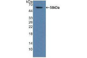 Figure. (ALDH1A1 抗体  (AA 2-501))