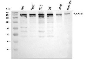 Western blot analysis of ch TOG/CKAP5 using anti-ch TOG/CKAP5 antibody (ABIN6719294).