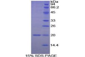 SDS-PAGE analysis of Human PPIF Protein. (PPIF 蛋白)