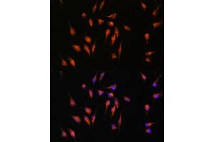 Immunofluorescence (IF) image for anti-Matrix Metallopeptidase 9 (Gelatinase B, 92kDa Gelatinase, 92kDa Type IV Collagenase) (MMP9) (AA 538-707) antibody (ABIN6143920)