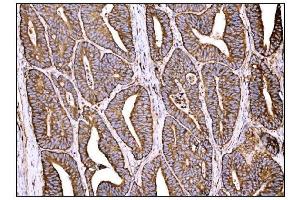 IHC analysis of HCCS using anti-HCCS antibody (ABIN7602424).