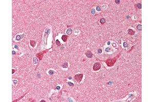 Anti-TF / Transferrin antibody IHC of human brain, cortex. (Transferrin 抗体)